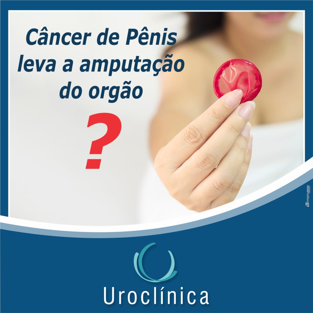 Cancer De Penis Uroclinica Umuarama