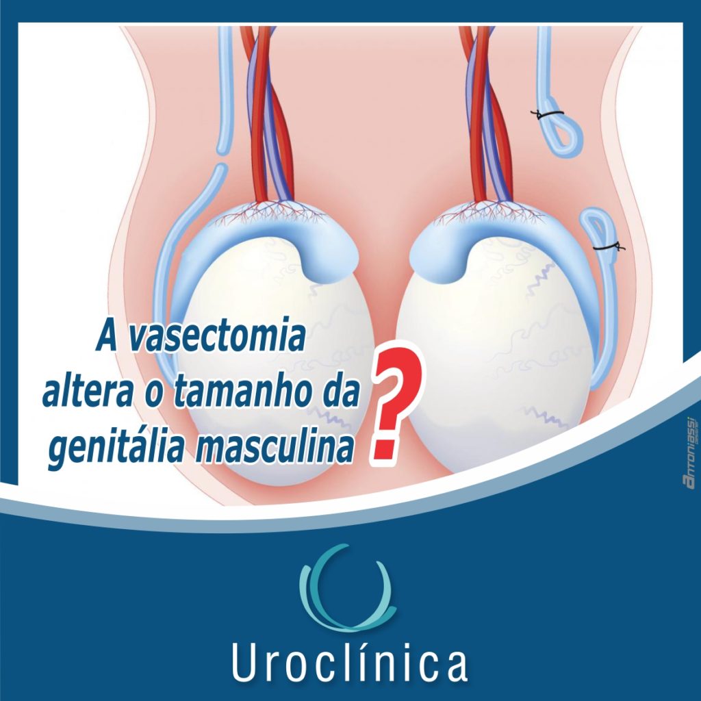 Anatomia De Vasectomia Masculina Do Sistema Reprodutor Masculino Porn